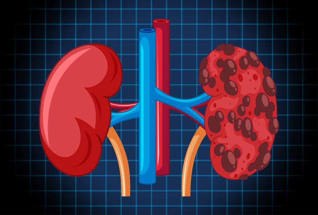 Human internal organ with kidneys