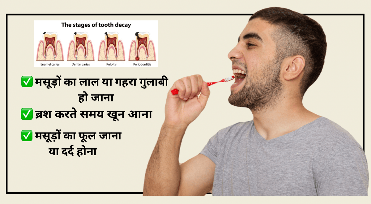 मसूड़ों में सूजन घरेलू उपचार: जानिए 10 असरदार तरीके